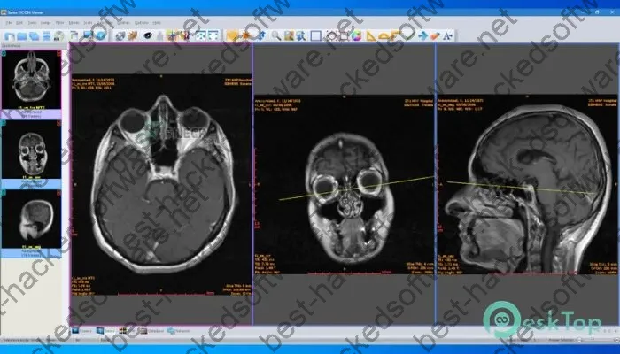 Sante Dicom Viewer Pro Crack 14.0.6 Full Free Download